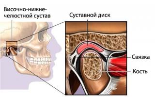 Определение центрального соотношения челюстей при полном отсутствии зубов